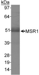 Detection of MSR I in human liver