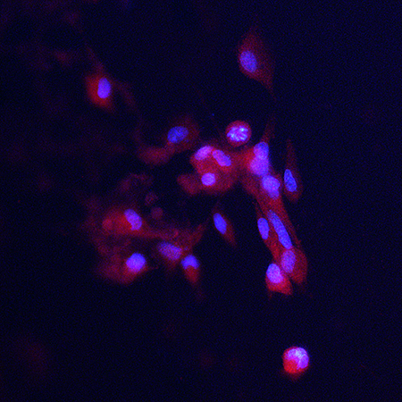 ACE-2 staining (red) and DAPI nuclear counterstain (blue) of the endothelial cells on the bottom of the inserts. Images collected on a microscope.