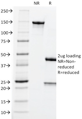 SDS-PAGE Analysis of Purified CEA Mouse Monoclonal Antibody (CEA31). Confirmation of Purity and Integrity of Antibody.