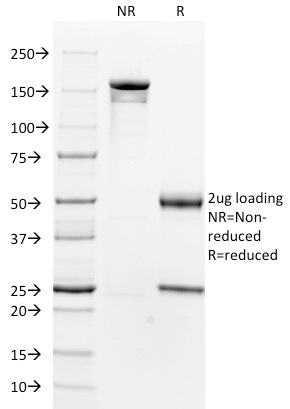 SDS-PAGE Analysis of Purified Smooth Muscle Actin Mouse Monoclonal Antibody (1A4). Confirmation of Integrity and Purity of Antibody.