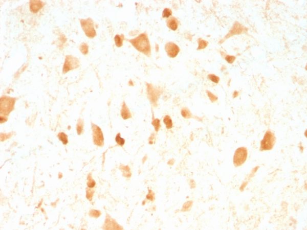 Formalin-fixed, paraffin-embedded Rat Cerebellum stained with Pgp9.5 Monoclonal Antibody (UCHL1/775).