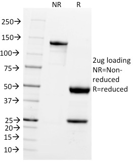 SDS-PAGE Analysis of Purified Pgp9.5 MAb (UCHL1/775). Confirmation of Purity and Integrity of Antibody.