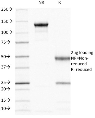 SDS-PAGE Analysis of Purified CD44 Mouse Monoclonal Antibody (156-3C11). Confirmation of Purity and Integrity of Antibody.