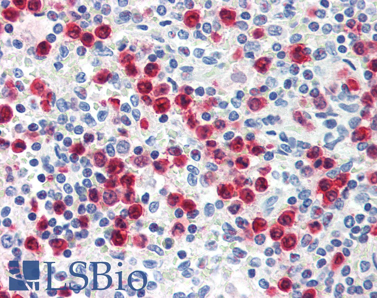 S100A8 / MRP8 Antibody - Anti-S100A8 antibody IHC of human spleen, granulocytes. Immunohistochemistry of formalin-fixed, paraffin-embedded tissue after heat-induced antigen retrieval. Antibody dilution 1:50. This image was taken for the unconjugated form of this product. Other forms have not been tested.