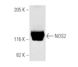 NOS2 Antibody (C-11) - Western Blotting - Image 3830 