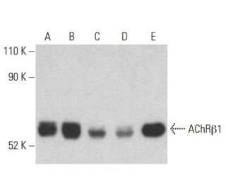 Nicotinic Acetylcholine Receptor beta 1/CHRNB1 Antibody (148) - Western Blotting - Image 401217 
