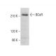 BCoR Antibody (C-10) - Western Blotting - Image 378200 