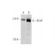 BCoR Antibody (C-10) - Western Blotting - Image 323824 