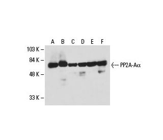 PP2A-A&alpha; Antibody (6G3) - Western Blotting - Image 19125 