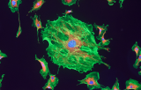 Sonde NTRK3 pour l'HIS CE/IVD - Cancers des glandes salivaires