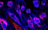 Sonde NUTM1 pour la FISH CE/IVD - Cancers des glandes salivaires