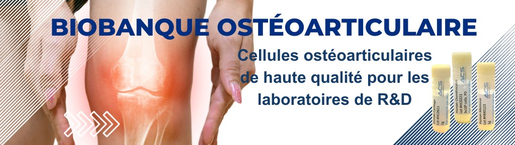 Biobanque ostéoarticulaire