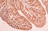 Substrats chromogènes pour l'IHC