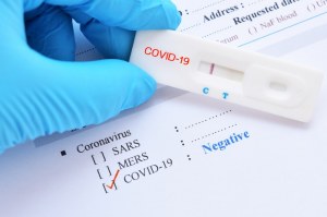 SARS-CoV-2 (Covid-19) : Test Rapide IgG/IgM pour le diagnostic