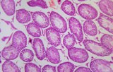 Substrats chromogènes pour l'IHC