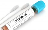 COVID-19 - Produits pour le diagnostic