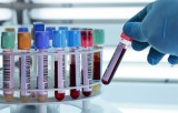 PCR directe sur échantillons de sang