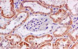 Immunohistochimie