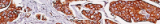 Coloration à la fuschine acide orange G (AFOG)