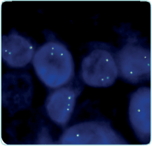 FISH ALK : nouvelle sonde pour automate BOND
