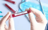 SARS-CoV-2 - Produits pour le diagnostic - Tests RT-qPCR