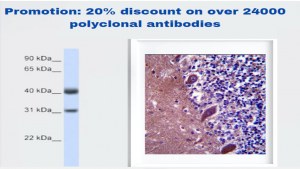 Promotion : 20% de réduction sur plus de 24000 anticorps polyclonaux